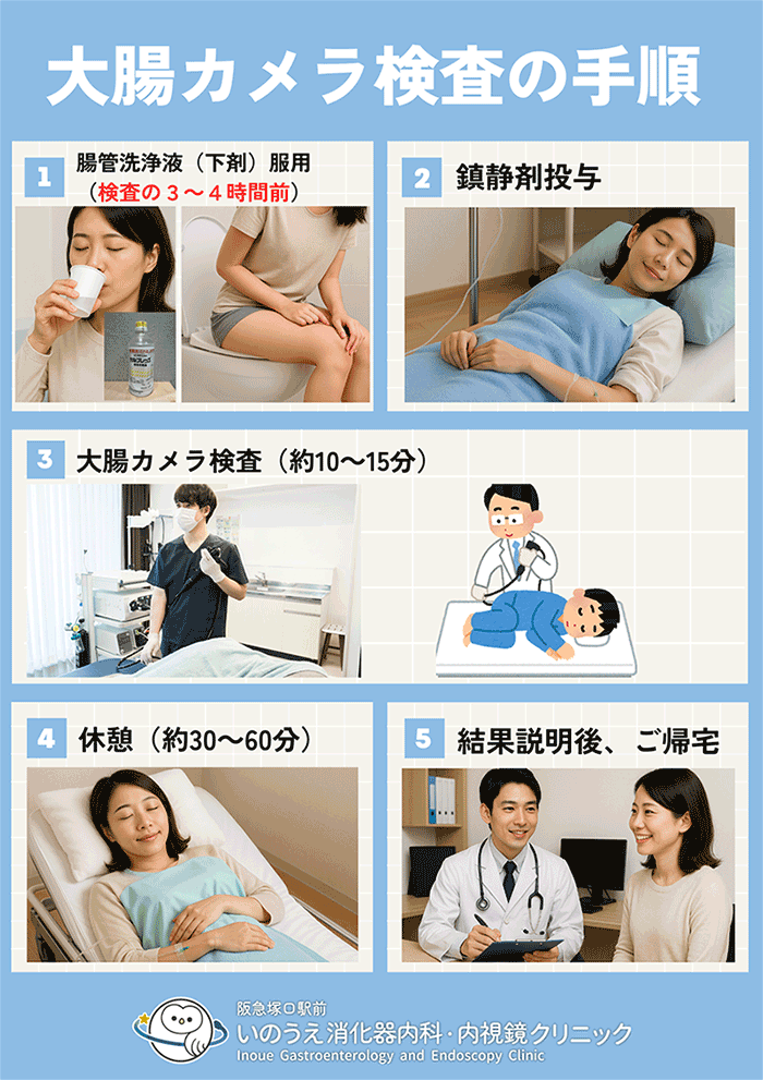 大腸カメラ検査の手順