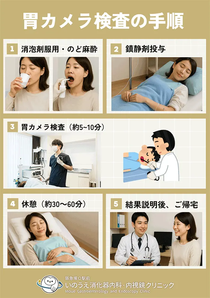 胃カメラ検査の手順