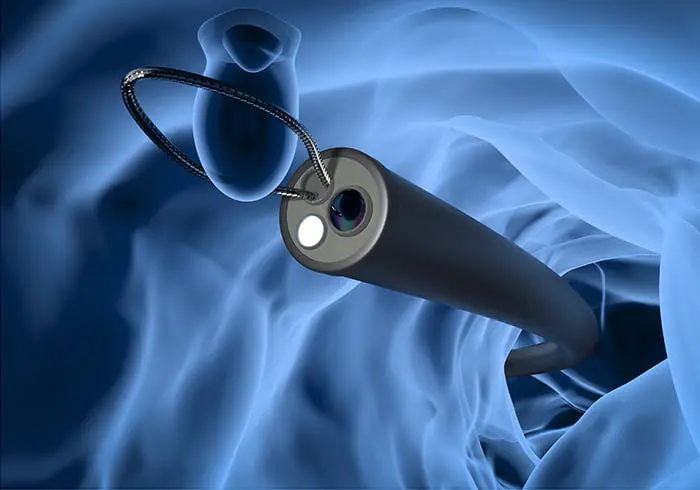 日帰りポリープ切除胃・大腸カメラの同日検査